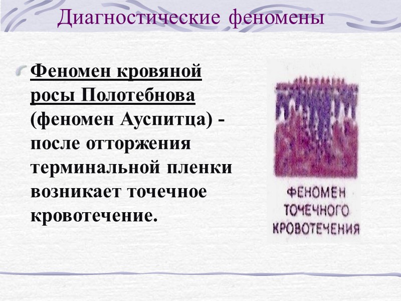 КЛИНИЧЕСКИЕ РАЗНОВИДНОСТИ ПСОРИАЗА  Псориаз обычный (psoriasis vulgaris) Характеризуется: Мономорфная сыпь в виде плоских